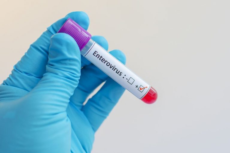 Alarma social, que no sanitaria, en Cataluña por Enterovirus.