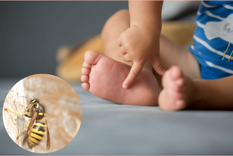 picaduras de avispas y abejas