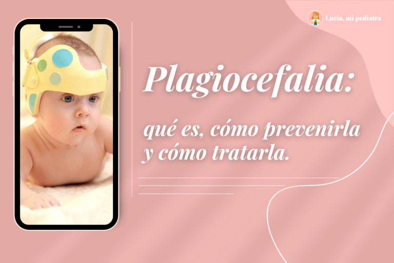 Plagiocefalia: qué es, cómo prevenirla y cómo tratarla.